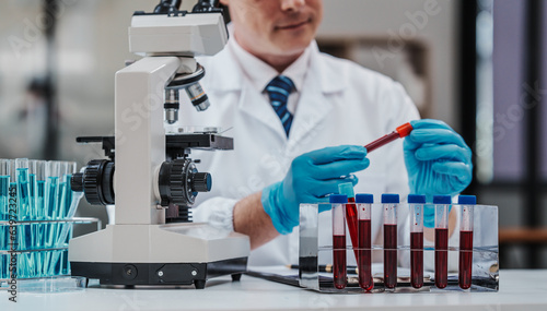 Chemologist explains examining blood in test tube. Examples of drugs for treatment of hematological diseases, blood diseases refer to diseases, disorders of the hematopoietic system, immune system