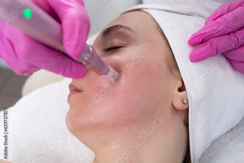 Closeup Cosmetologist Making Mesotherapy Injection With Dermapen On Face, Cheek Area Of Young Woman For Rejuvenation In Spa Center. Patient Getting Needle Mesotherapy, Skincare. Horizontal Plane