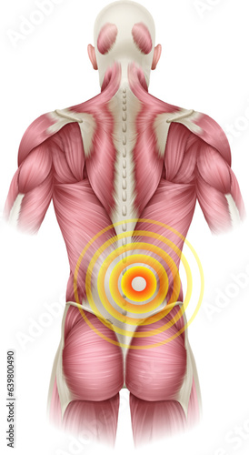 Tablou pe pânză Lower back pain concept