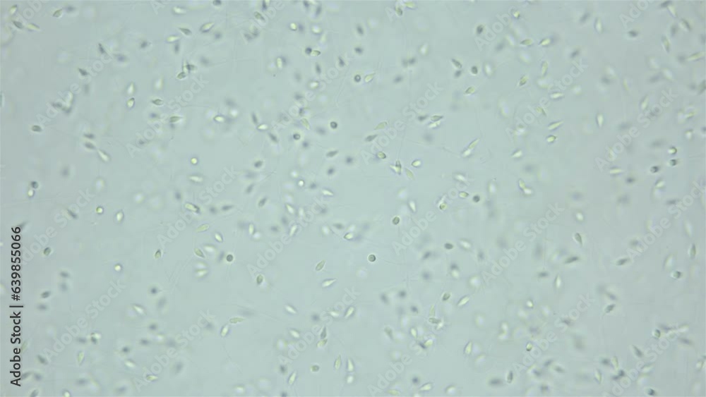 Sperm sea urchin Strongylocentrotus pallidus under microscope, phylum Echinodermata. White sea Sperm sea urchin Strongylocentrotus pallidus under microscope, phylum Echinodermata. White sea