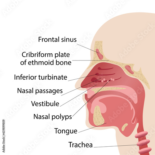 Longitudinal section of the diagram of the anatomy of the human nose. Polyps of the nose