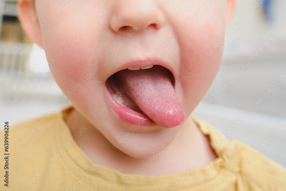 Fototapeta premium The protruding tongue of the child. Baby aged two years (two-year-old boy)