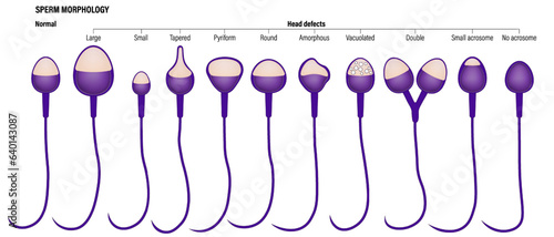 Normal and head defects spermatozoon. Semen analysis vector. Sperm morphology. Male reproductive system.