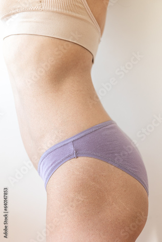 Female body with stretch marks on the buttocks photo