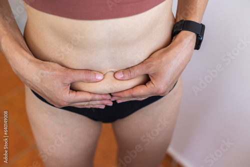 Принти на полотні Female body with stretch marks on the abdomen, stretch marks on the skin after losing weight, postpartum skin changes