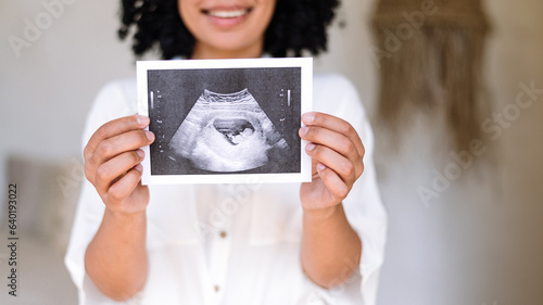 Happy woman holding in hands sonography photo of baby