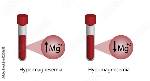 hypermagnesemia, high plasma magnesium level and hypomagnesemia, low plasma magnesium level. magnesium Mg excess and deficit electrolyte disorders, blood test tube, Scientific vector