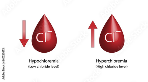 Hyperchloremia, high plasma chloride level and Hypochloremia, low plasma chloride level. Chloride excess and deficit electrolyte disorders, blood droplet, Scientific design. Vector illustration. photo