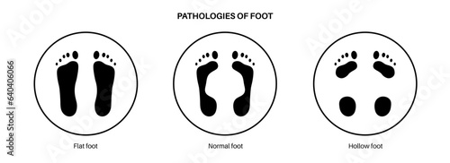 Foot pathologies poster