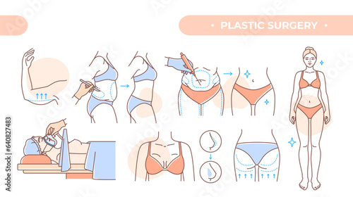 Plastic surgery set. Outline cosmetology and beauty treatments. Medical operations mammoplasty and gluteoplasty, abdominal and arm lifting. Linear flat vector collection isolated on white background