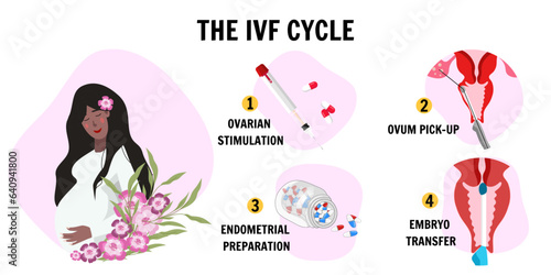 In vitro fertilization IVF infographics and illustrations with steps 