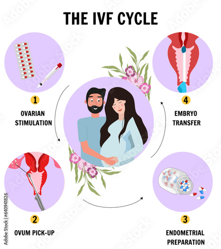 In vitro fertilization IVF flat infographics and illustration with steps of additional techniques