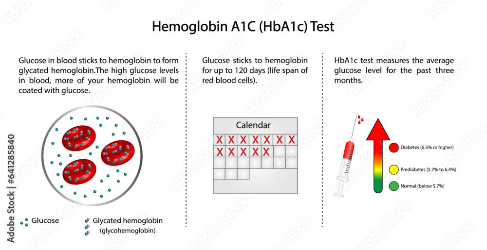 Hemoglobin A1C, HbA1c test , HbA1c levels, Glucose sticks to hemoglobin