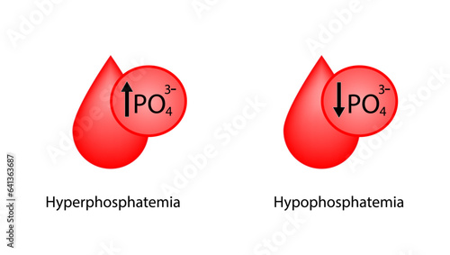 Hyperphosphatemia, high plasma phosphate level and Hypophosphatemia, low plasma phosphate level. phosphate excess and deficit electrolyte disorders, blood droplet, Scientific Vector illustration. photo