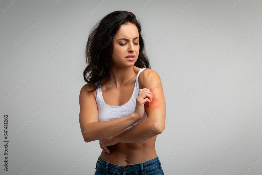 Obraz premium Young indian woman scratching red spots on her shoulder