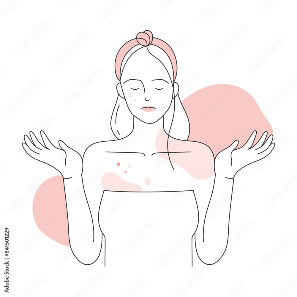 Girl with skin allergic reaction. Itchy body skin, covered with red rash line vector illustration Girl with skin allergic reaction. Itchy body skin, covered with red rash line vector illustration