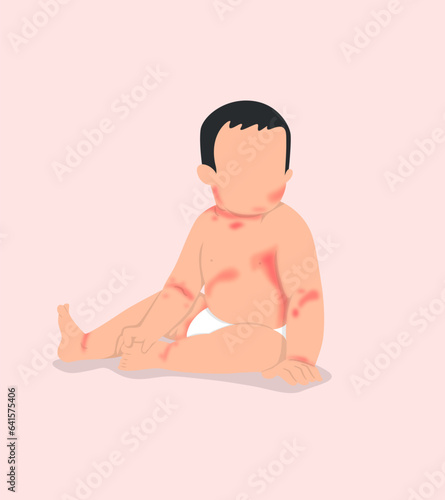 A baby with a rash on the skin