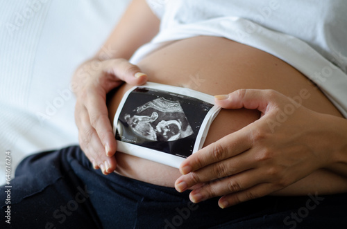 Pregnant woman holding an ultrasound image of the baby. Close-up of pregnant belly and ultrasound photography in mother's hands. Untied and healthy pregnancy concept photo