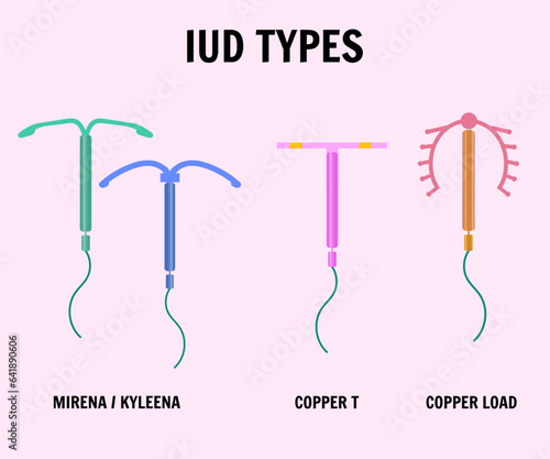  IUD intrauterine device types, medical information and illustration