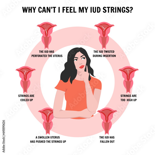  IUD intrauterine device, medical information and illustrations