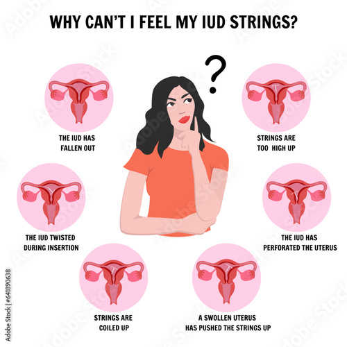  IUD intrauterine device, medical information and illustrations