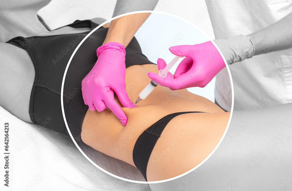 Φωτογραφία A doctor of aesthetic cosmetology makes lipolytic injections to burn body fat on a woman’s stomach and body