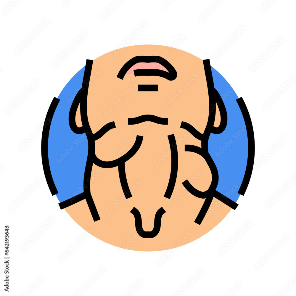Swollen Lymph Nodes Disease Symptom Color Icon Vector Swollen Lymph swollen-lymph-nodes-disease-symptom-color-icon-vector-swollen-lymph