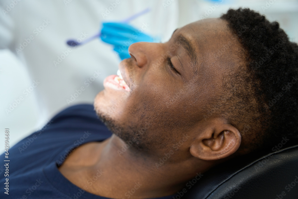 Close up photo of smiling man at the dentist Close up photo of smiling man at the dentist