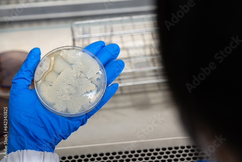 Scientist hand wearing blue gloves hold agar plate for diagnosis bacterial or microorganism in the hood at laboratory. Selective petri dish with colonies of bacteria