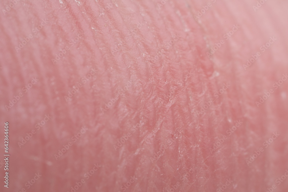 Skin friction ridges on finger as background, macro view
