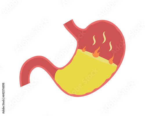 Unhealthy human stomach. Heartburn concept vector illustration