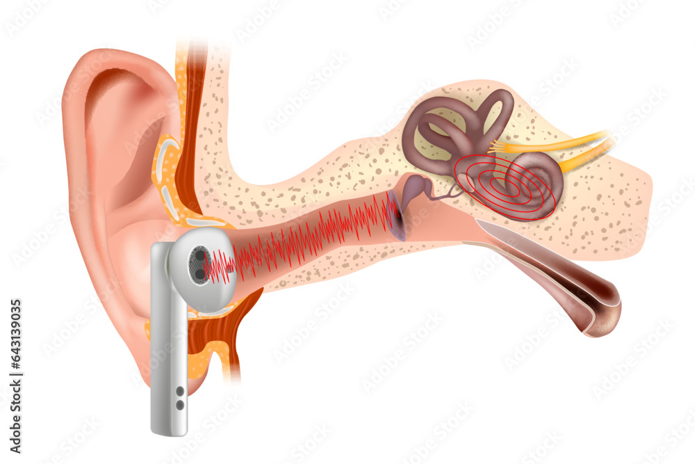 Vetor de Hearing damage. Loud sound from vacuum headphones damage the
