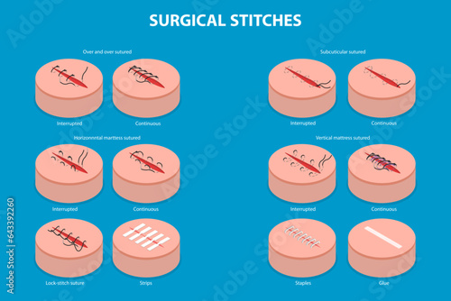 3D Isometric Flat Vector Conceptual Illustration of Surgical Stitches