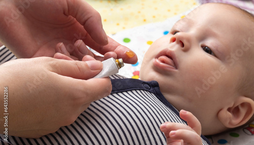 Bilde på lerret mother applies special anesthetic gel when teething baby, close-up