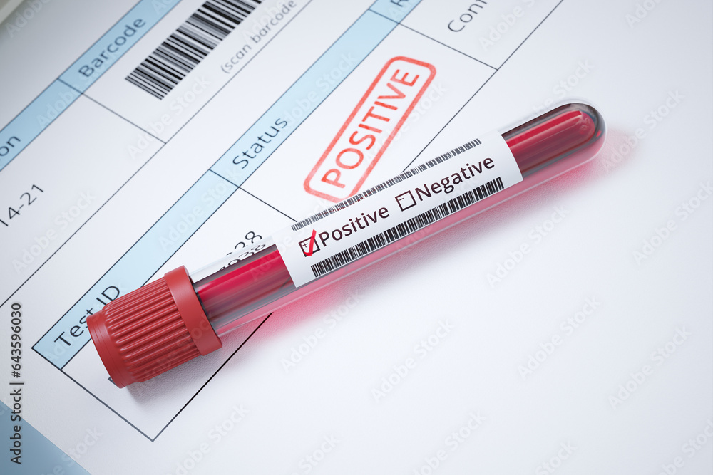 Blood sample with a positive test. Viral infection. Patient documents