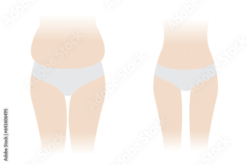 Comparison of woman body fat and slim vector isolated on white background. The woman with fat belly, hip, thigh and slender body. Slim waist compared to body fat. Before and after weight loss.