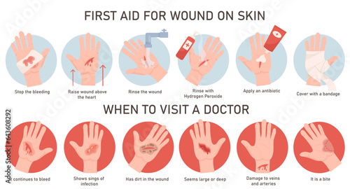 Emergency situation and first aid treatment for wound on hand skin infographic medical poster