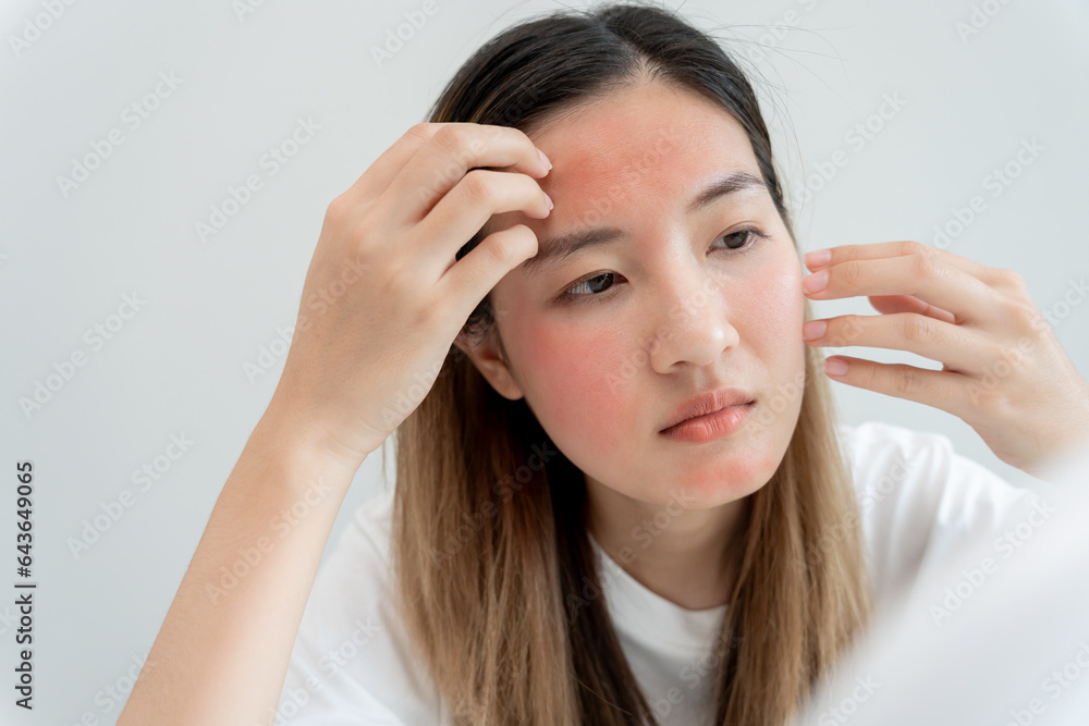 Woman worried about face Dermatology, rosacea dermatitis, allergic steroids, sensitive skin, red face from sunburn, acne, dry skin, large pores ,rash face, dull, freckles, wrinkle, skin problem Woman worried about face Dermatology, rosacea dermatitis, allergic steroids, sensitive skin, red face from sunburn, acne, dry skin, large pores ,rash face, dull, freckles, wrinkle, skin problem