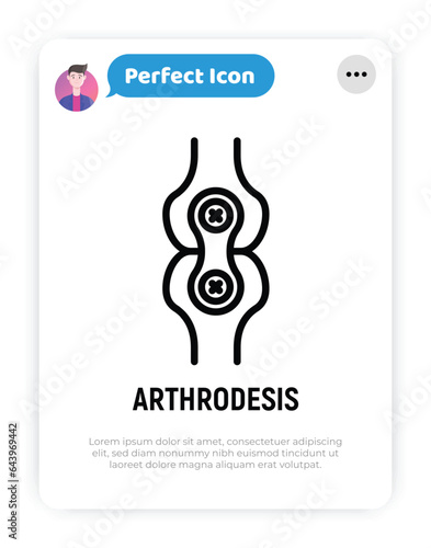 Arthrodesis joint surgery thin line icon. Arthritis. Vector illustration.