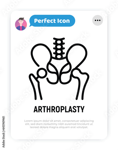 Arthroplasty thin line icon, artificial joint, surgical procedure to restore joint. Arthritis. Vector illustration.