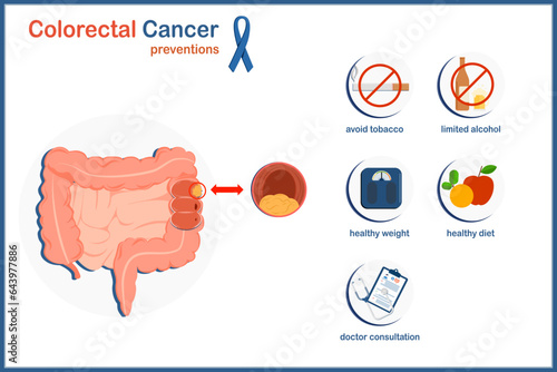 Medical vector illustration concept.Human colorectal cancer.Colorectal cancer preventions.avoid tobacco,limited alcohol,healthy weight,healthy diet and doctor consultation.isolated on white background