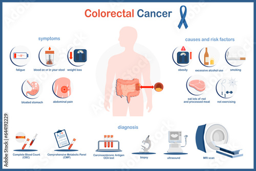 Vector infographic illustration of colon cancer. Medical illustration concept. Colon cancer symptoms, causes and Risk factors  and diagnosis of bowel cancer.flat style isolated on white background.