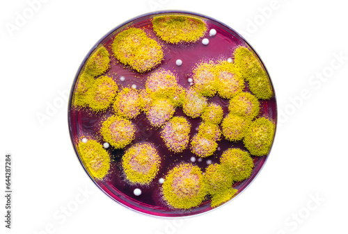 Fungal colonies from a soil sample growing in a petri dish with rose bengal agar (DRBC)