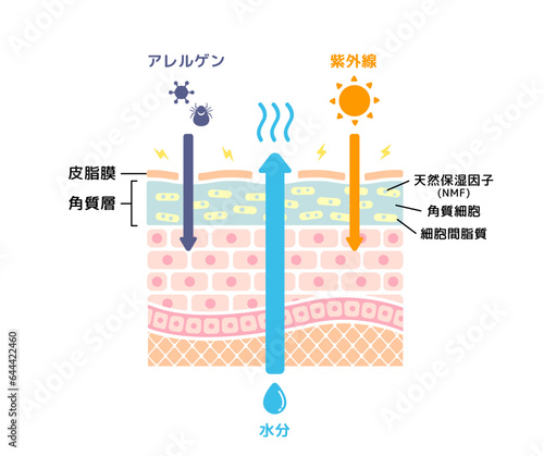 乾燥肌の皮膚断面 イラスト