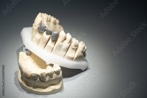 Models of human teeth. Dent...