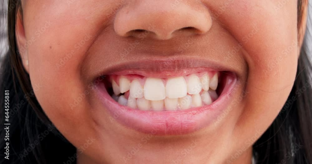 Smile, happy and closeup of mouth of child in city for happiness, joy and facial expression. Dental care, youth and face zoom of young girl for teeth whitening for confidence, pride and oral health Smile, happy and closeup of mouth of child in city for happiness, joy and facial expression. Dental care, youth and face zoom of young girl for teeth whitening for confidence, pride and oral health
