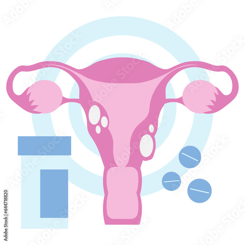 uterus ovaries cervix cancer in flat llustration