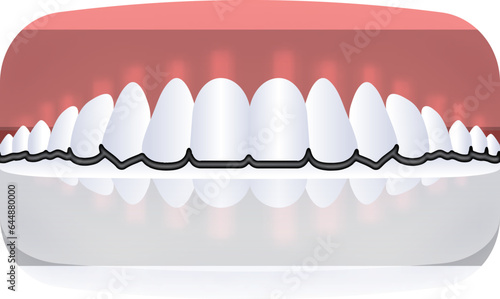 Deep Bite Human Teeth Icon In Red And White Color.