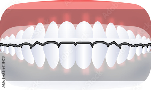 Flat Underbite Teeth Jaw Icon In Red And White Color.