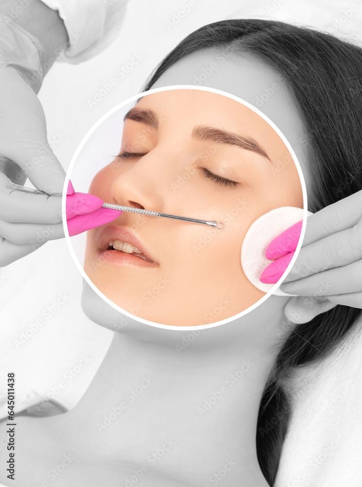 Naklejka premium A procedure for cleansing the skin of the face from blackheads and acne. Cosmetologist treats problematic skin of a young woman's face in a beauty salon. Aesthetic cosmetology and makeup concept.